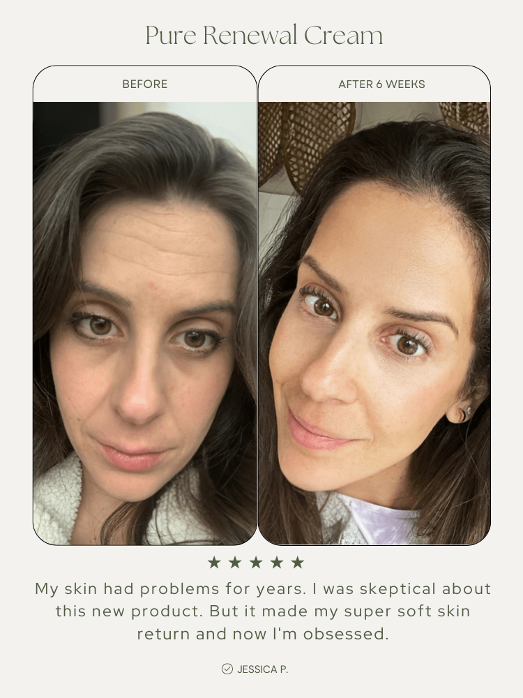 Pure Renewal Cream