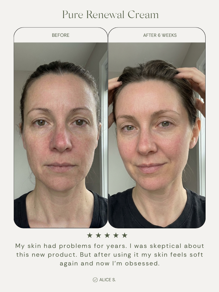 Pure Renewal Cream